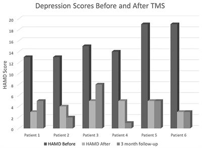 Novel TMS for Stroke and Depression (NoTSAD): Accelerated Repetitive Transcranial Magnetic Stimulation as a Safe and Effective Treatment for Post-stroke Depression